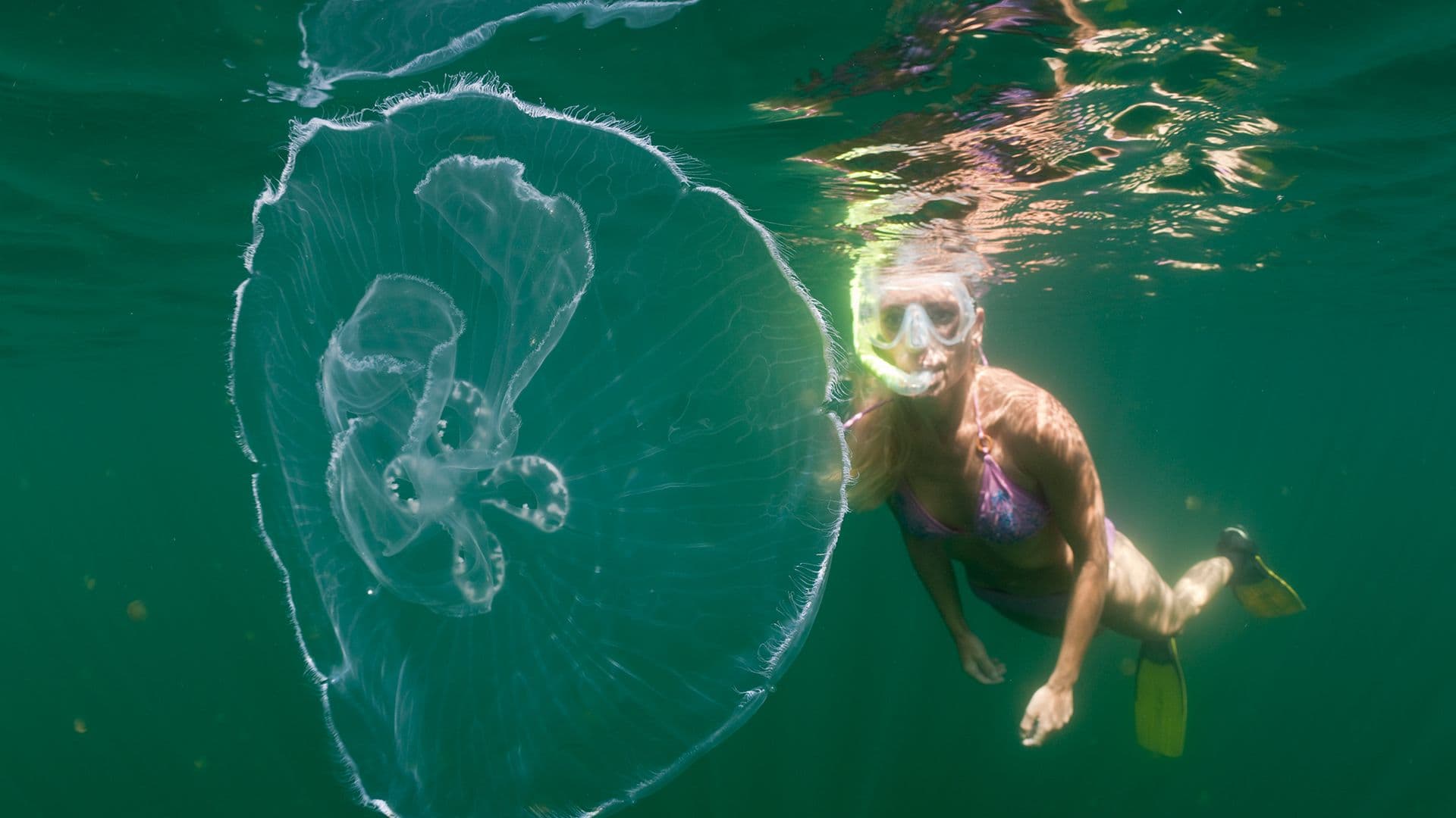 You should pee on a jellyfish sting. illustration